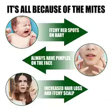 Dustmite & Bed Bug Killer Spray | Anti-Bacterial Cleaner